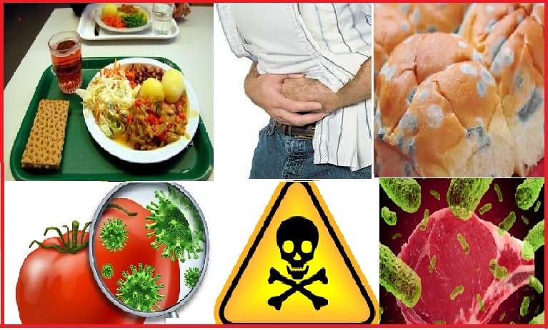 intoxications alimentaires 