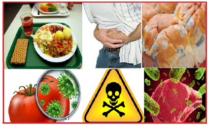 intoxications alimentaires